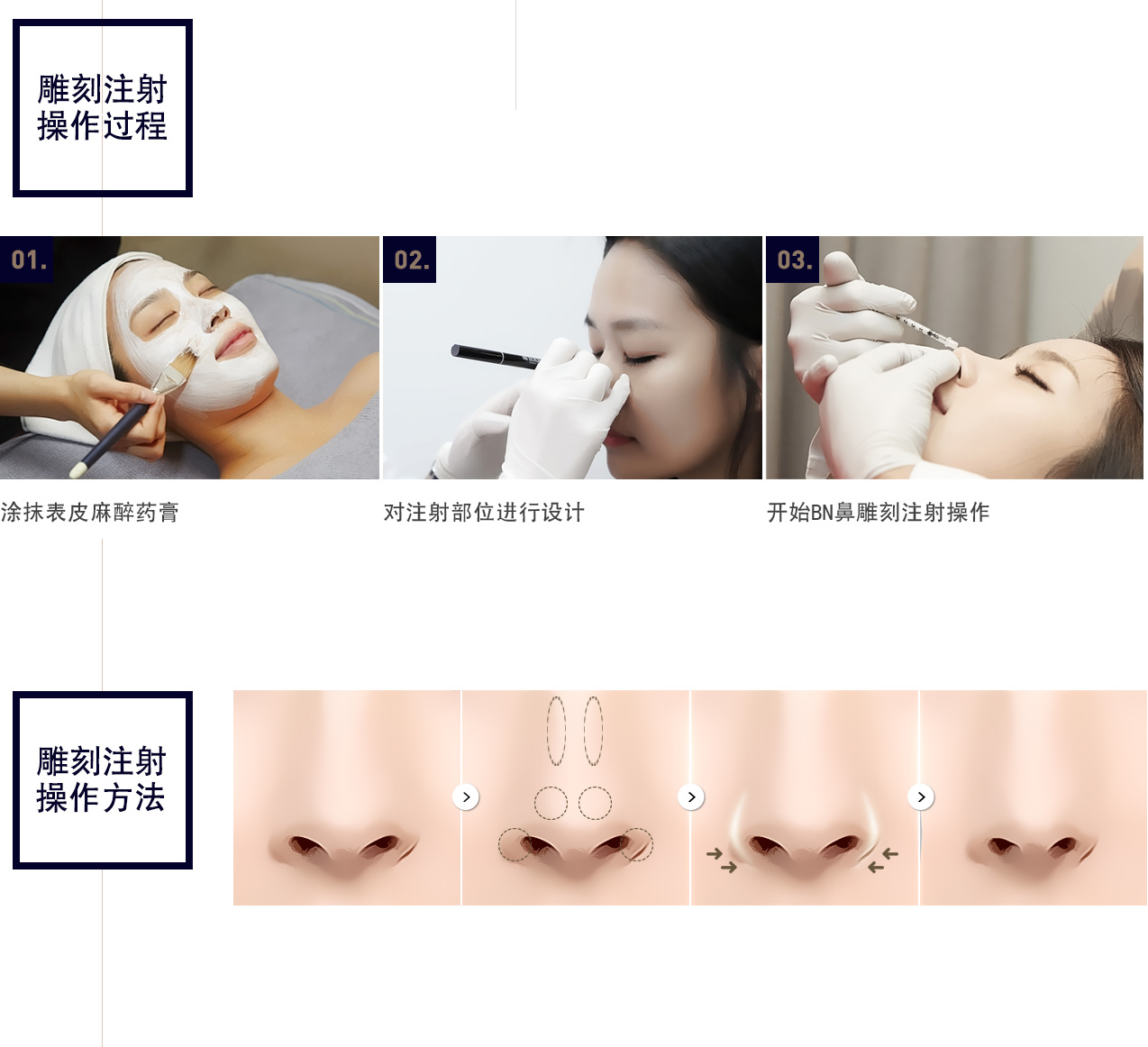 비앤조각주사