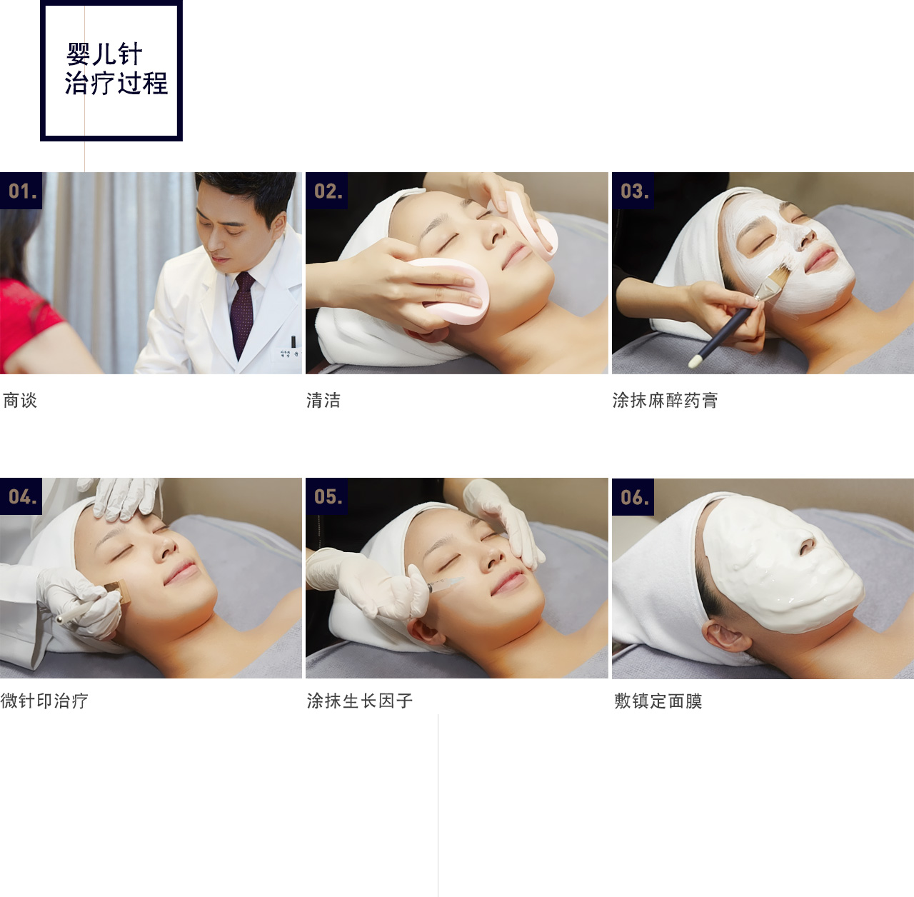 비앤아기주사