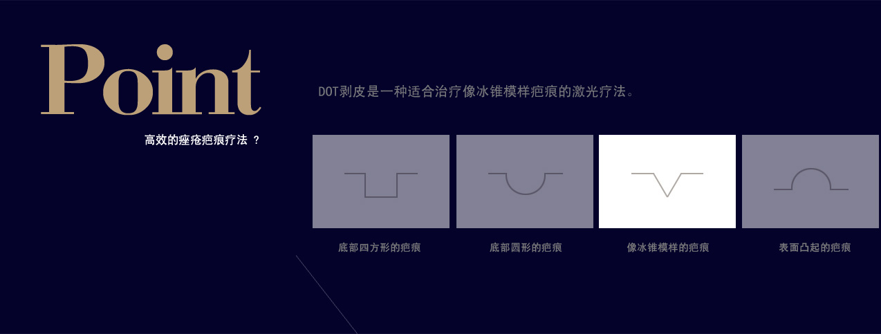 도트필링
